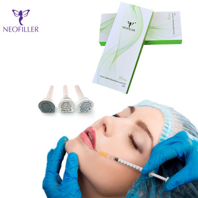Сторона впрыски Ha наполнителя 1ml 2ml Derm Ha тонкой Derm глубокой Hyaluronic кислоты дермальная