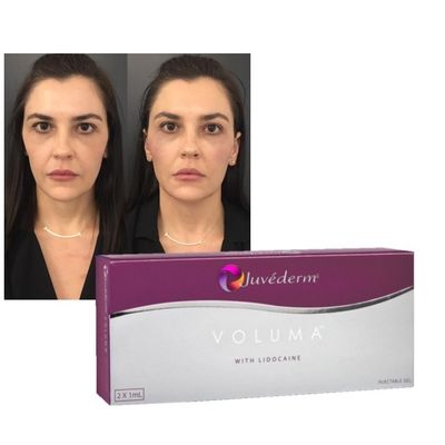 Juvederm Dermal Lip Fillers Гиалуроновая кислота с перекрестной инъекцией