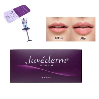 Allergan Juvederm Dermal Filler Injection Ultra4 с лидо
