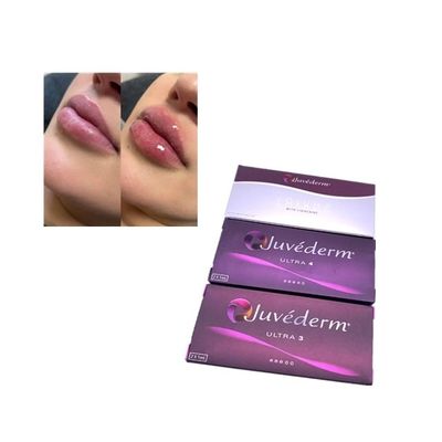 Инъекционный Juvederm Voluma Cross Linked Dermal Filler