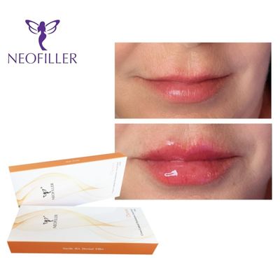 1 мл гиалуроновой кислоты Dermal Filler Инъекционный гель 9-12 месяцев Естественное омоложение Улучшение лица