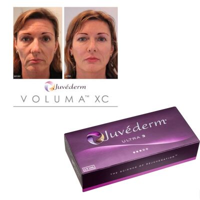 Juvederm Dermal Filler Инъекционный гель с гиалуроновой кислотой на 6-9 месяцев Длительность и хранение при комнатной температуре