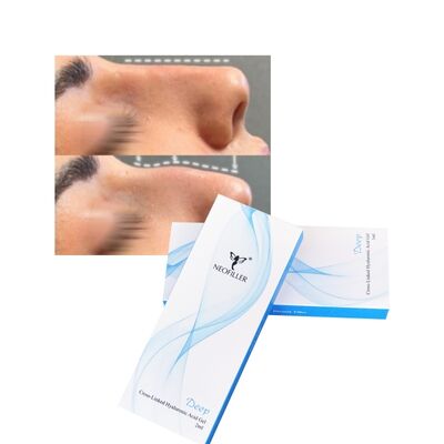 Скрещенный 2 мл гиалуроновой кислоты Dermal Filler Deep Line Контур носа Инъекционный гель для улучшения лица