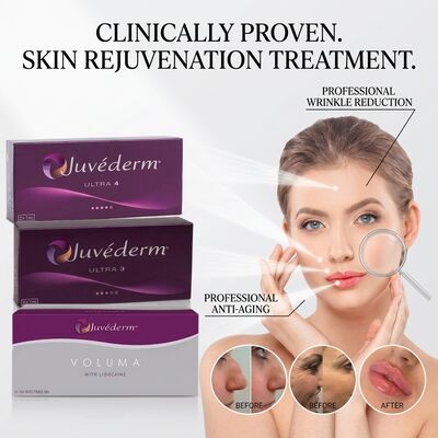 Juvederm Ultra 3 Наполнитель носолобиальных складков Гиалуроновая кислота Дермальное наполнитель для сглаживания линий улыбки 24 мг/ мл