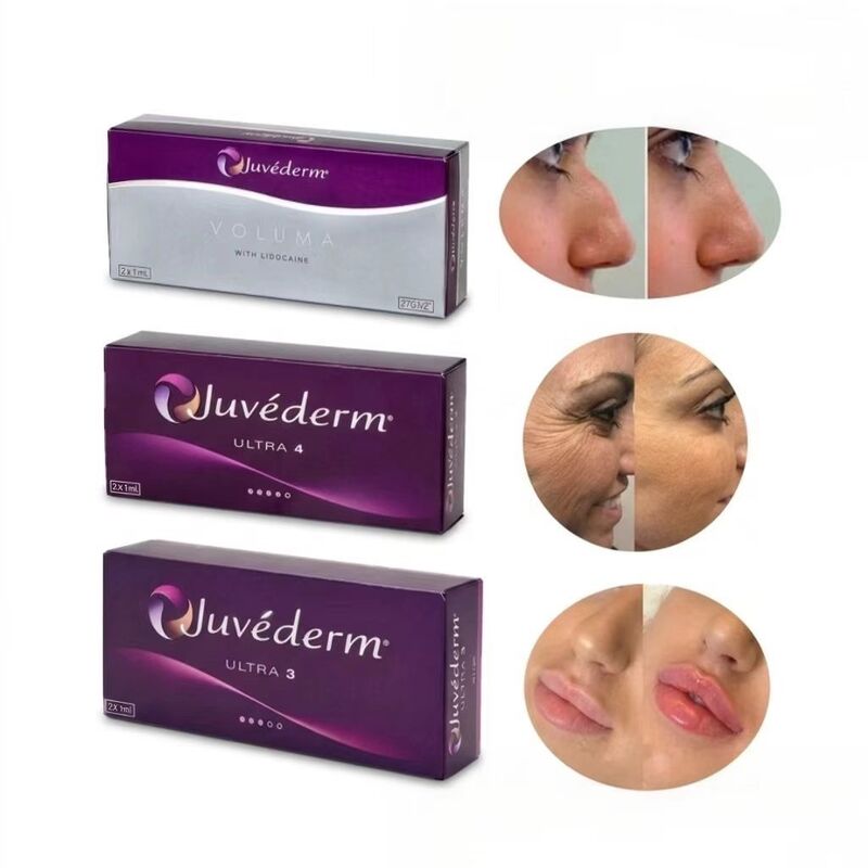 24 мг/ мл Juvederm Lip Filler Juvederm Ultra3 Ultra4 объем Инъекционный